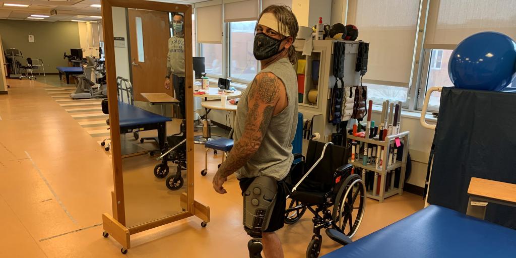 man with prosthetic leg