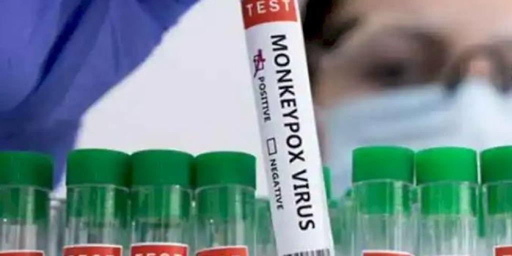 monkeypox