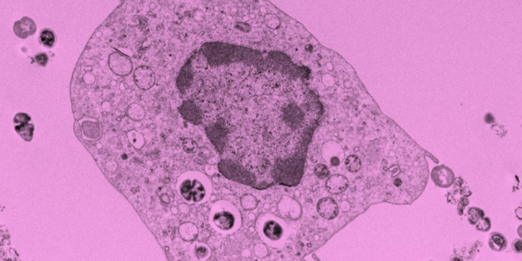 Transmission electron micrographs of placental macrophages with group B streptococcus inside of them.