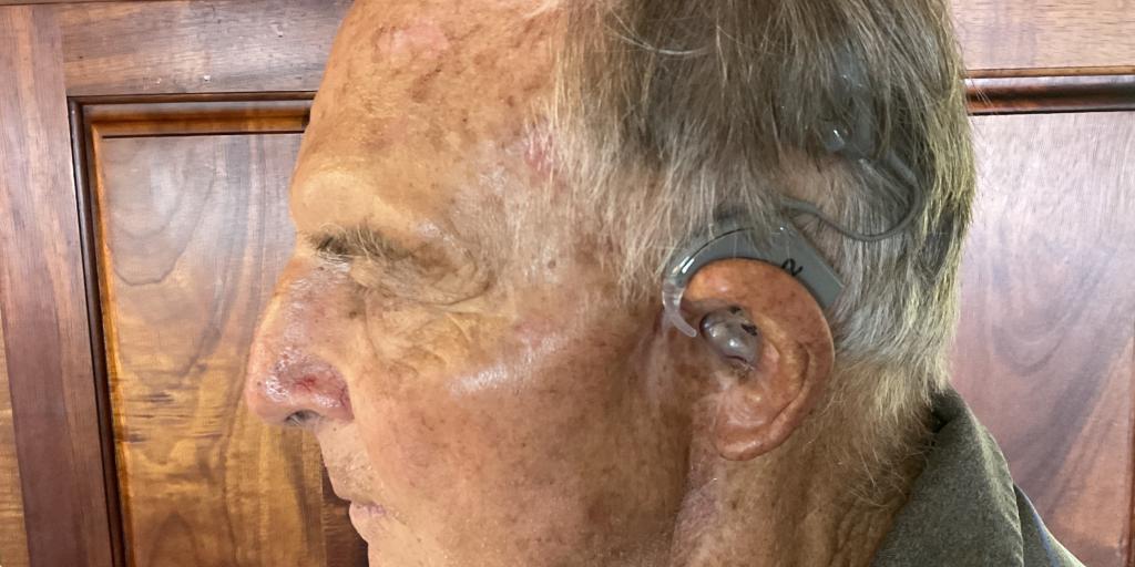 Retired Marine Corps Veteran Ronald Garten shows his cochlear implant