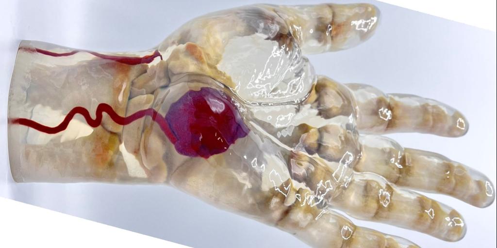A model of a human hand includes bones and blood vessels within a transparent material used for skin and muscles.