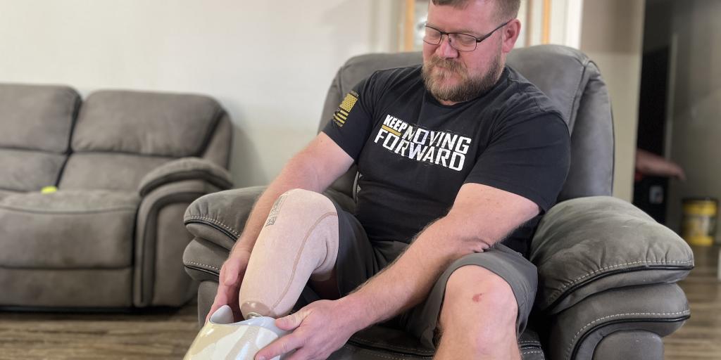 Veteran dons a prosthetic limb.